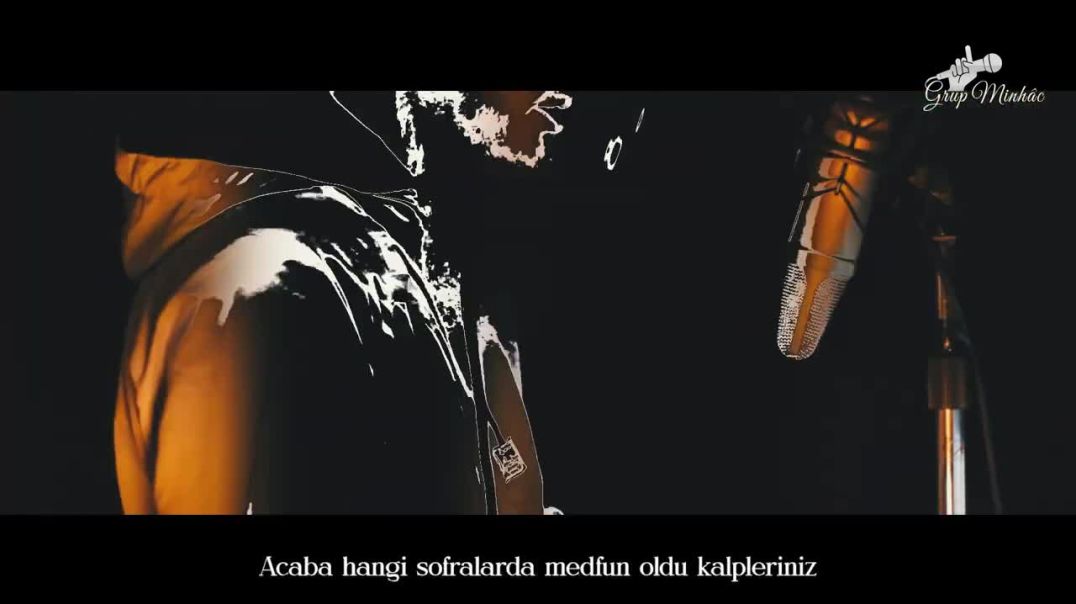 انشودة تركيا "Bir Derdim Var